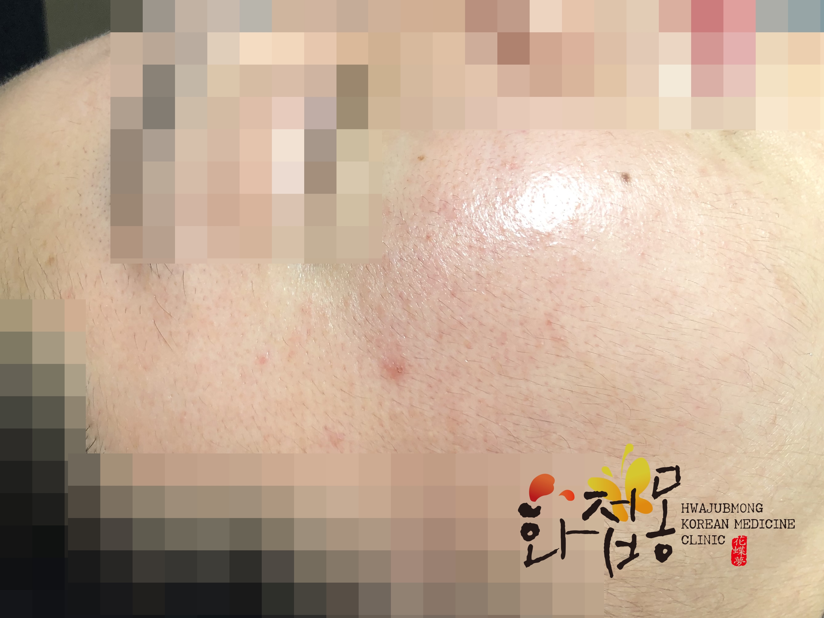 전후사진
