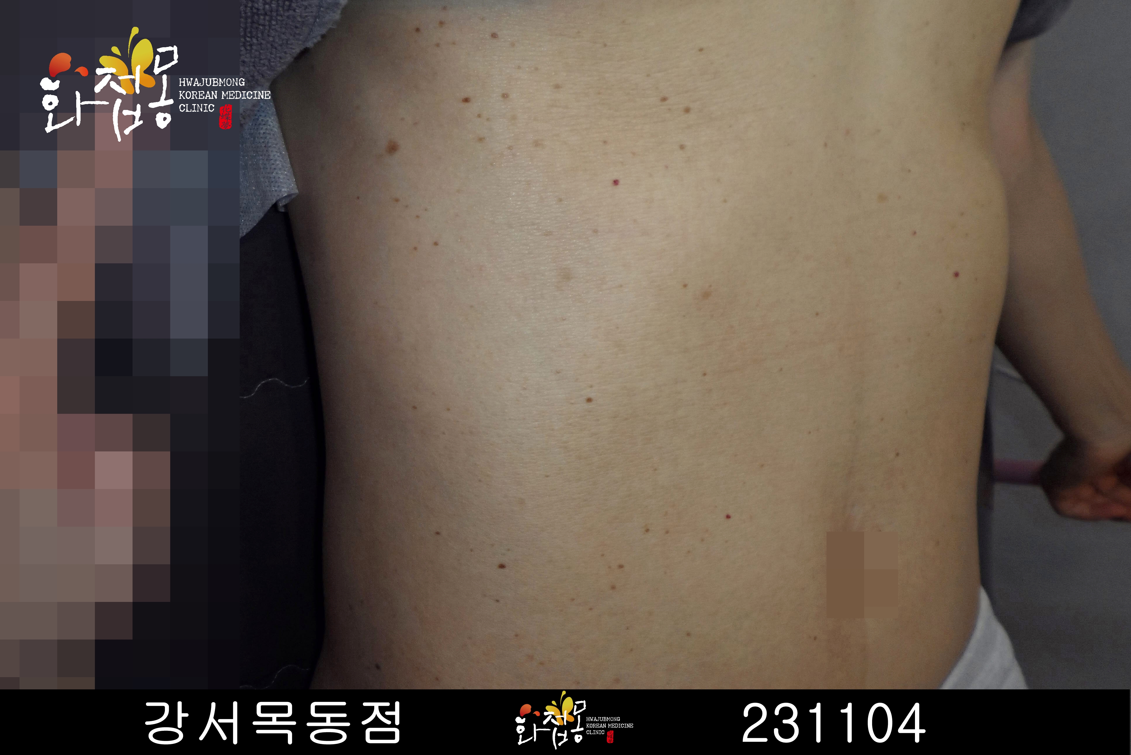 전후사진