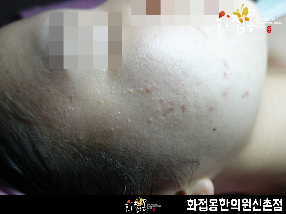전후사진