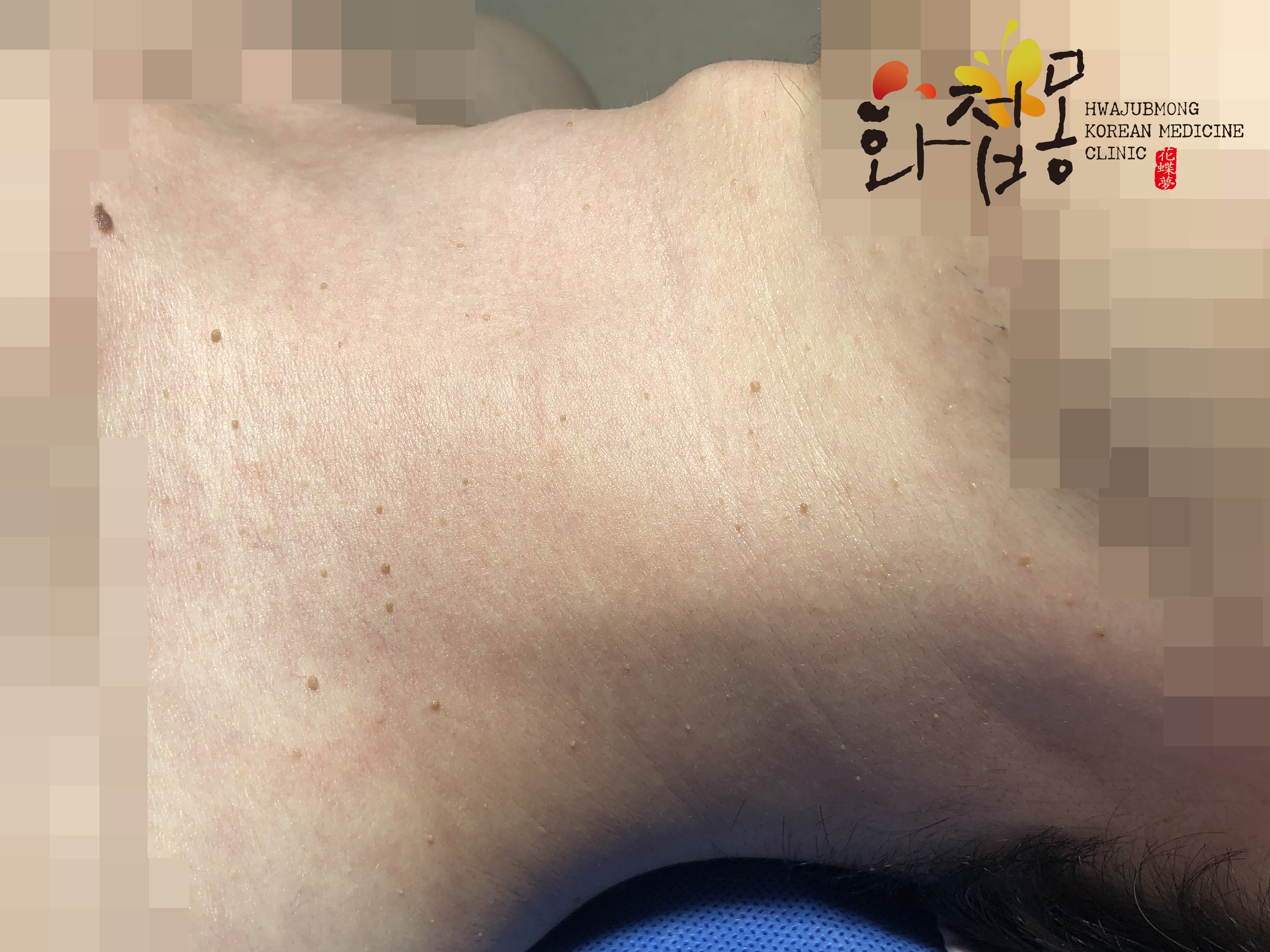 전후사진