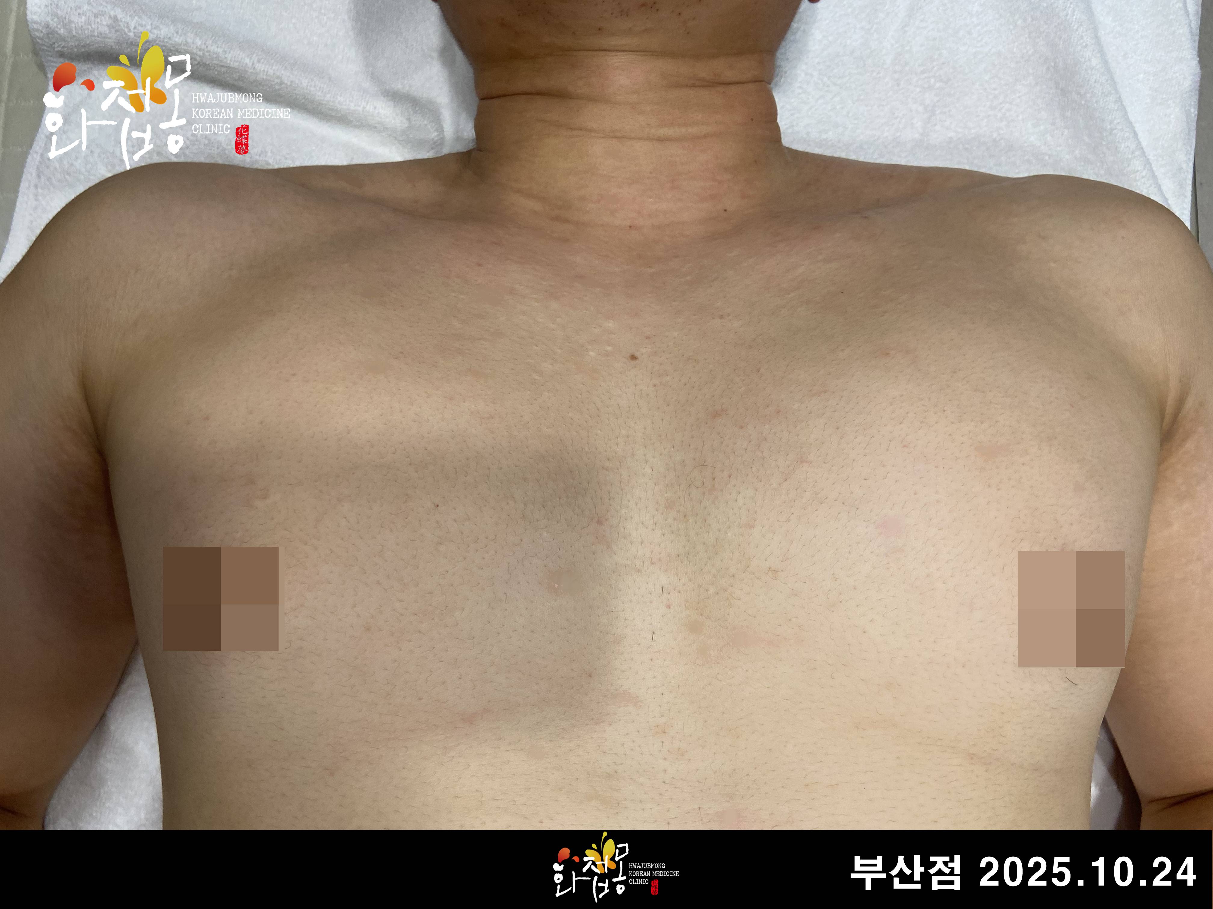 전후사진